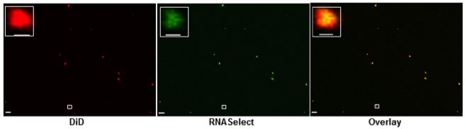 Figure 2: Confocal microscopy analysis of OMVs, stained with lipid tracer dye, DiD (red) and RNA specific dye, SYTO RNASelect (green). The area highlighted within the white rectangular box is magnified in the inset. The scale bar is equivalent to 5 µm in the main images and equivalent to 500 nm in the magnified images. Each individual colour dot in the images likely represents the aggregation of several OMVs, as the typical sizes of OMVs are below the limit of resolution of confocal microscopy.