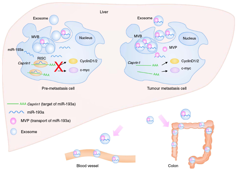 Figure 1: Model for the mechanism of colon cancer metastasis to the liver. Tumor suppressor mir-193a is sorted into exosomes by Major Vault Protein (MVP) and then secreted from the cell.