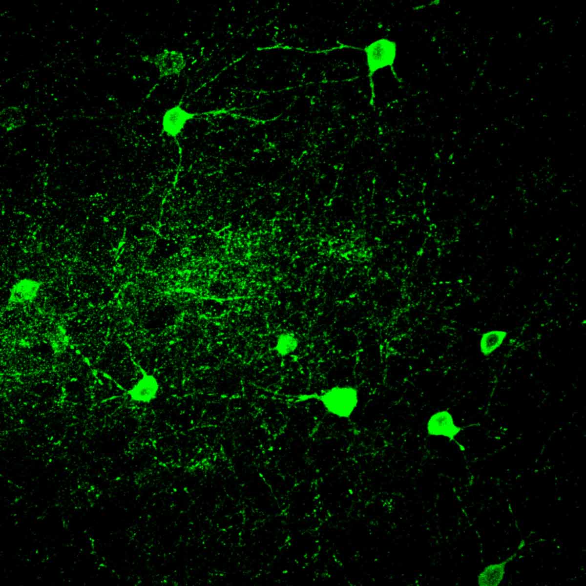 Mouse parvalbumin neurons